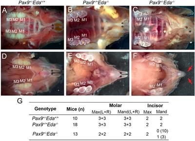 Pax9’s Interaction With the Ectodysplasin Signaling Pathway During the Patterning of Dentition